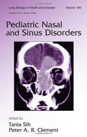 [PDF] دانلود کتاب Pediatric Nasal And Sinus Disorders, 2005