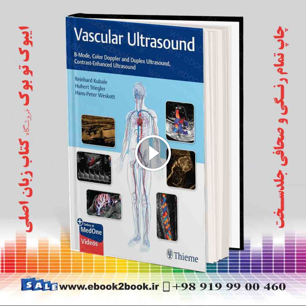 Vascular Ultrasound