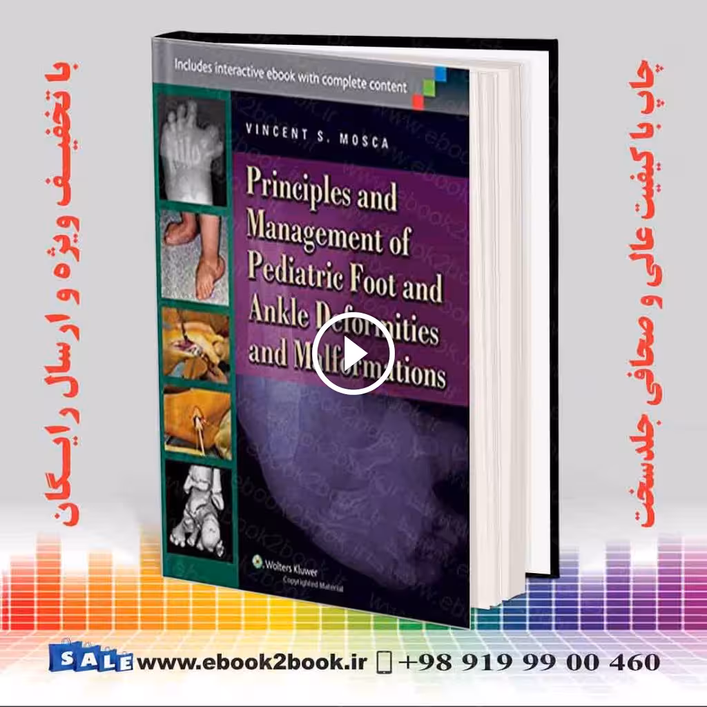 Principles and Management of Pediatric Foot and Ankle Deformities and Malformations