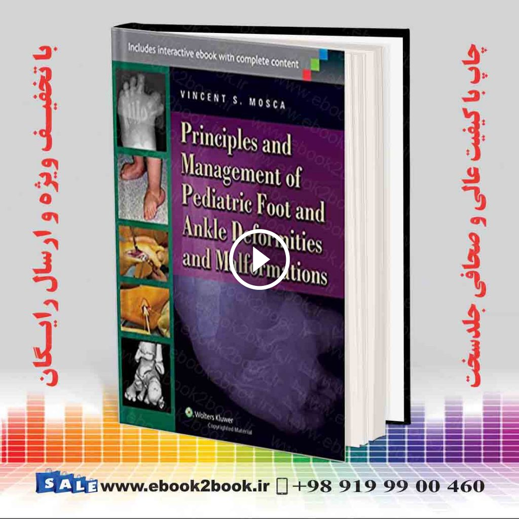 Principles and Management of Pediatric Foot and Ankle Deformities and Malformations