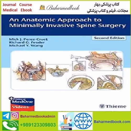 An Anatomic Approach to Minimally Invasive Spine Surgery TRU