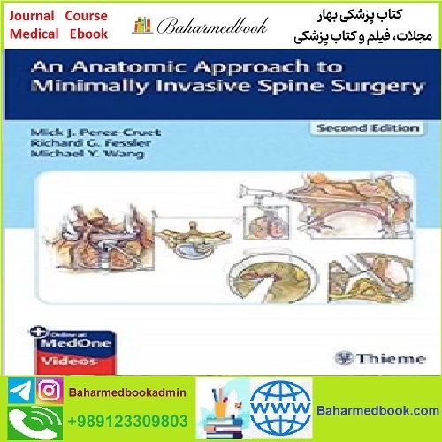 An Anatomic Approach to Minimally Invasive Spine Surgery TRU