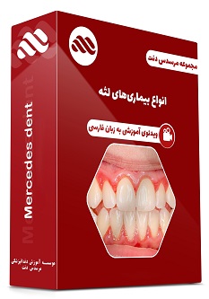 ویدئوی انواع بیماریهای لثه (زبان فارسی)