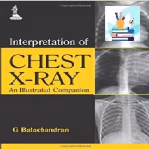 Interpretation of Chest X-Ray TRUE PDF price 1€
