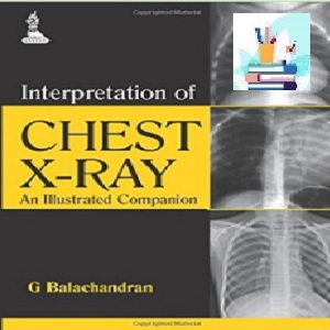 Interpretation of Chest X-Ray TRUE PDF price 1€