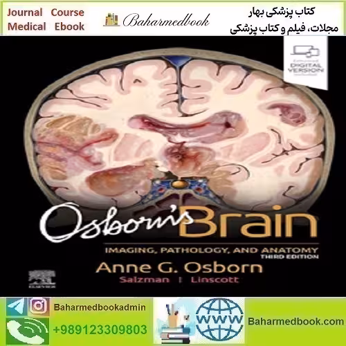 Osborn's Brain 2024 EPUB   CONVERTED PDF price 2€ - کتاب پزشکی بهار