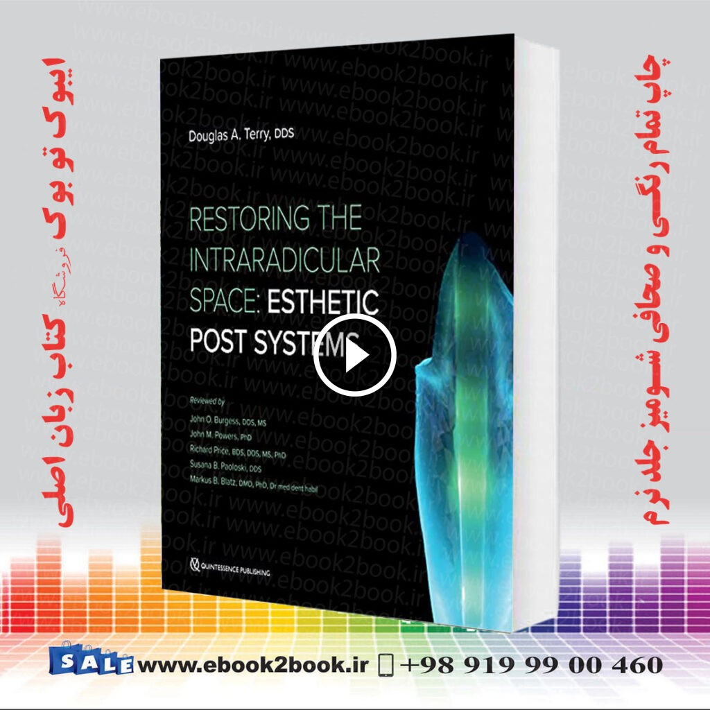 Restoring the Intraradicular Space : Esthetic Post Systems