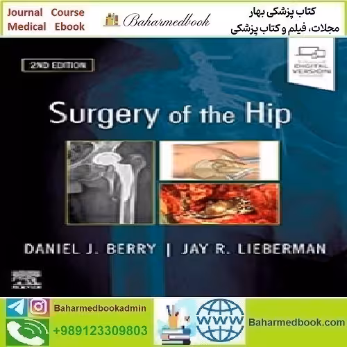 Surgery of the Hip 2020 TRUE PDF price 3€ - کتاب پزشکی بهار