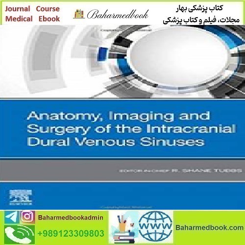 Anatomy Imaging and Surgery of the Intracranial Dural Venous
