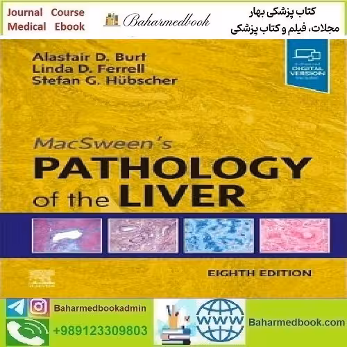 MacSween's Pathology of the Liver 2024 TRUE PDF price 2€ - کتاب پزشکی بهار