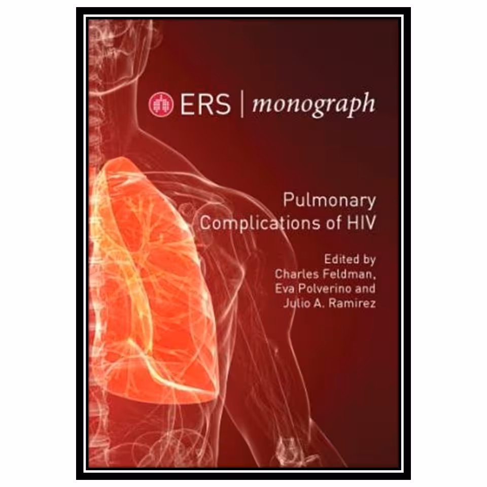 کتاب Pulmonary Complications of HIV اثر جمعی از نویسندگان انتشارات مؤلفین طلایی