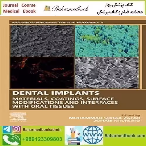 Dental Implants Materials Coatings Surface Modifications and