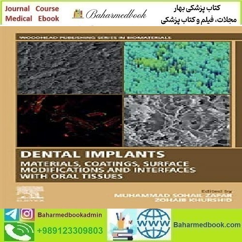 Dental Implants Materials Coatings Surface Modifications and