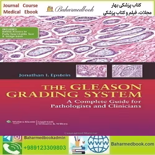 The Gleason Grading System A Complete Guide for Pathologist