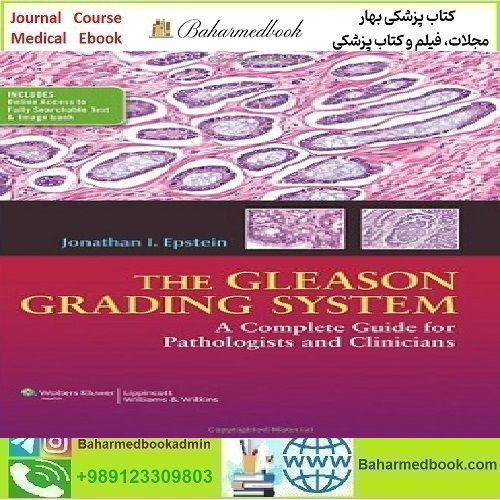 The Gleason Grading System A Complete Guide for Pathologist