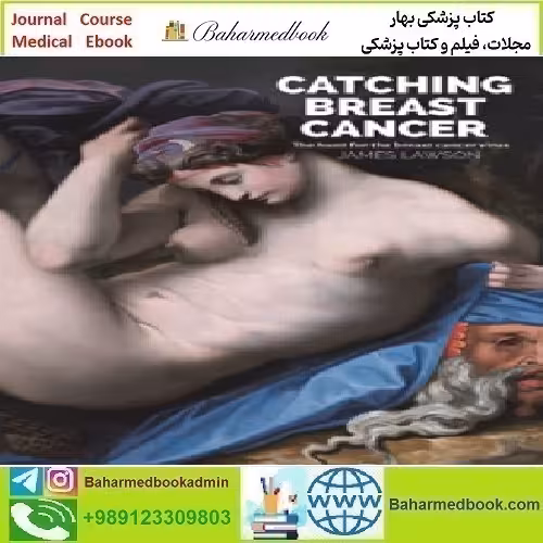 Catching Breast Cancer 2022 TRUE PDF price 1€ - کتاب پزشکی بهار