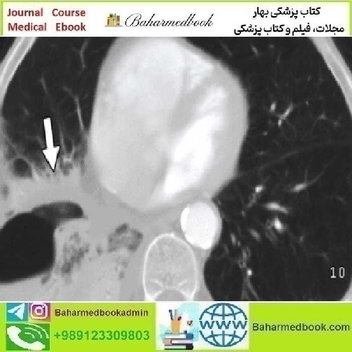 ARRS Radiology Review Multispecialty Cases 2019 video cours