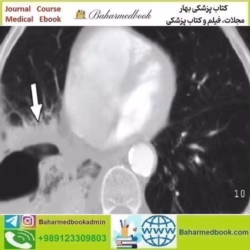 ARRS Radiology Review Multispecialty Cases 2019 video cours