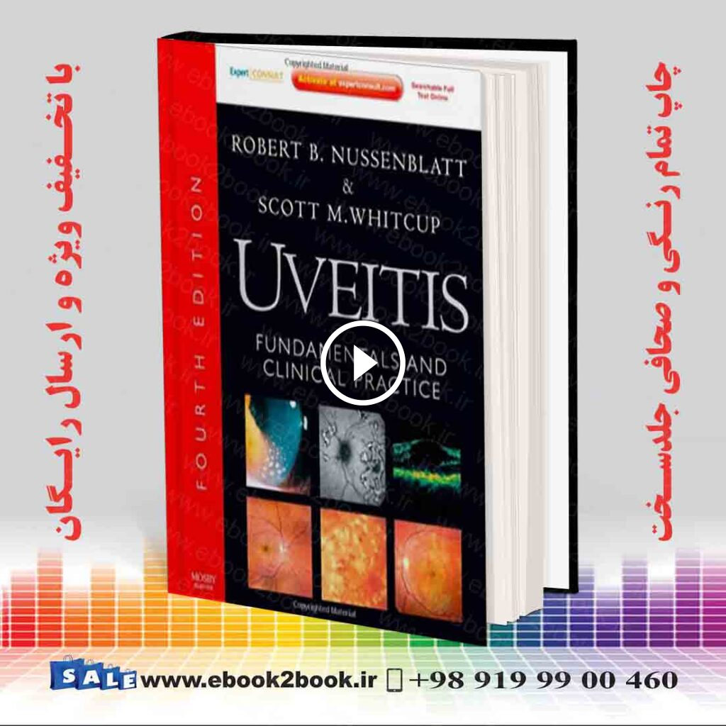 Uveitis: Fundamentals and Clinical Practice 4th Edition