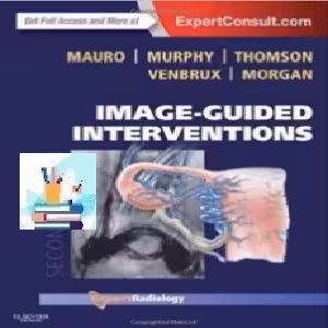Image-Guided Interventions TRUE PDF price 1€