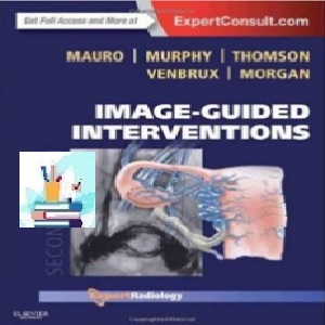 Image-Guided Interventions TRUE PDF price 1€