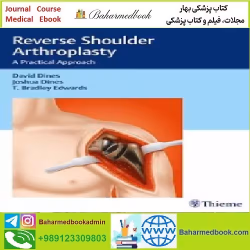 Reverse Shoulder Arthroplasty A Practical Approach TRUE PDF