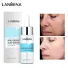 سرم پوست لنبنا مدل HYALURONIC ACID حجم 15 میلی لیتر