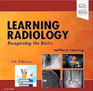 Learning Radiology Recognizing the Basics TRUE PDF price 1€