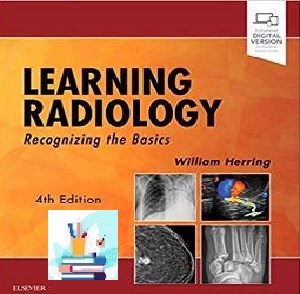 Learning Radiology Recognizing the Basics TRUE PDF price 1€
