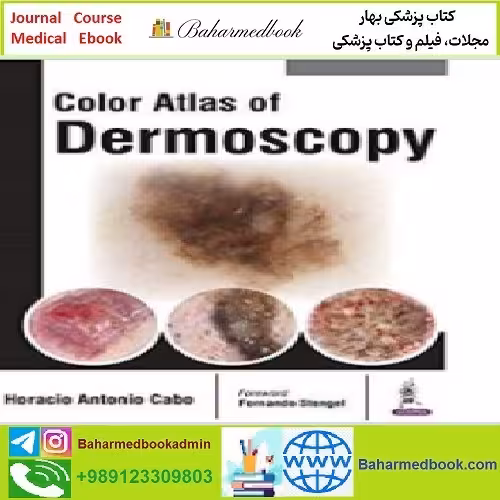 Colour Atlas of Dermoscopy TRUE PDF price 1€ - کتاب پزشکی بهار