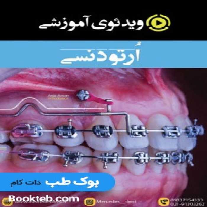 ویدئوی جامع ارتودنسی (انگلیسی)