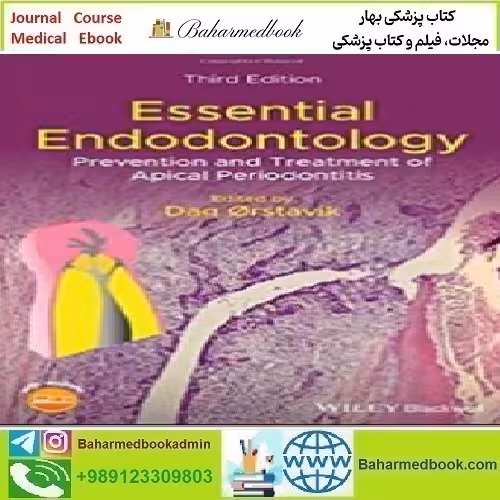 Essential Endodontology 2020 TRUE PDF price 1€ - کتاب پزشکی بهار