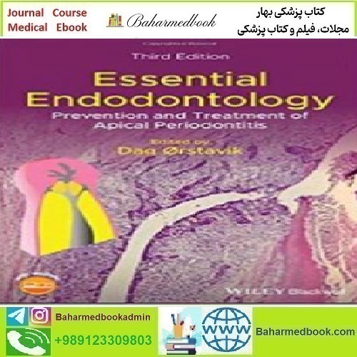 Essential Endodontology 2020 TRUE PDF price 1€ - کتاب پزشکی بهار
