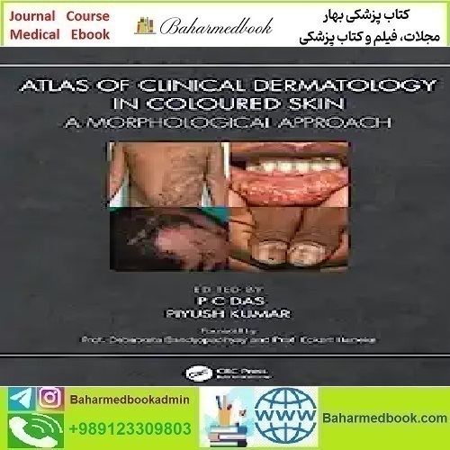 Atlas Of Clinical Dermatology In Coloured Skin A Morph