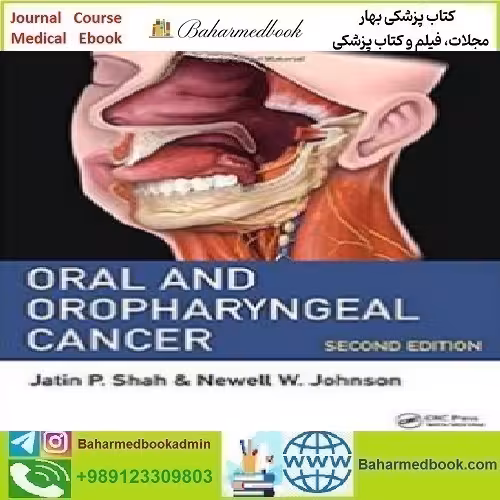 Oral and Oropharyngeal Cancer 2019 TRUE PDF price 1€ - کتاب پزشکی بهار