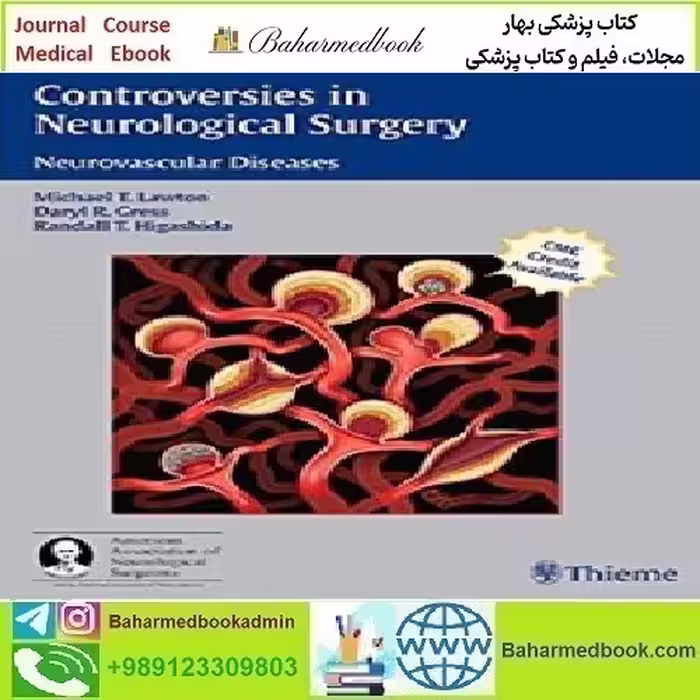 Controversies in Neurological Surgery Neurovascular Diseases 2