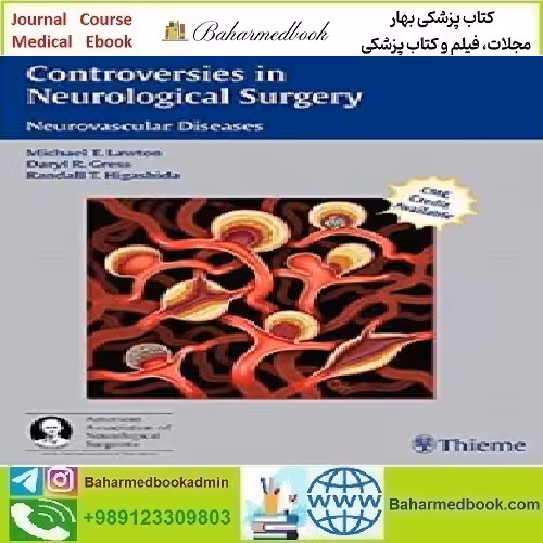 Controversies in Neurological Surgery Neurovascular Diseases 2