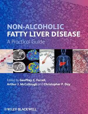 [PDF] دانلود کتاب Non-Alcoholic Fatty Liver Disease - A Practical Guide, 2013