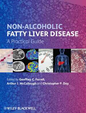 [PDF] دانلود کتاب Non-Alcoholic Fatty Liver Disease - A Practical Guide, 2013