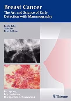 Breast Cancer: The Art and Science of Early Detection with Mammography - کتاب پزشکی بهار