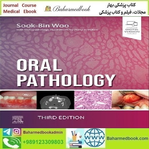 Oral Pathology 2024 TRUE PDF price 4€ - کتاب پزشکی بهار