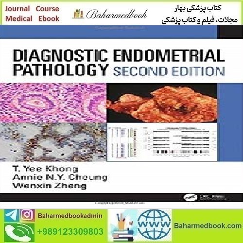 Diagnostic Endometrial Pathology 2019 TRUE PDF price 1€ - کتاب پزشکی بهار