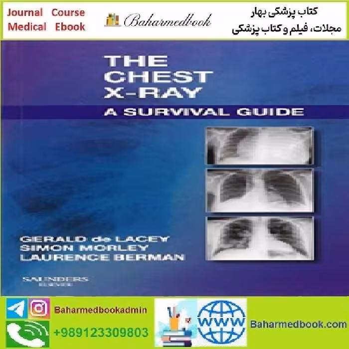 The Chest X Ray A Survival Guide TRUE PDF price 1€ - کتاب پزشکی بهار