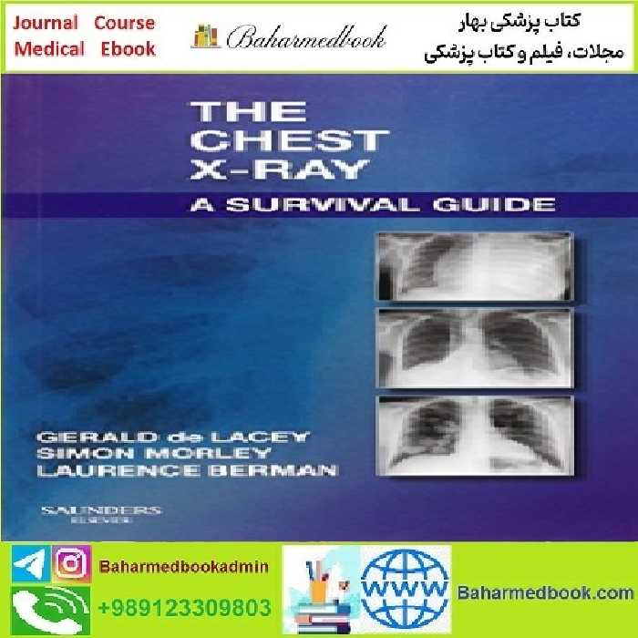 The Chest X Ray A Survival Guide TRUE PDF price 1€ - کتاب پزشکی بهار