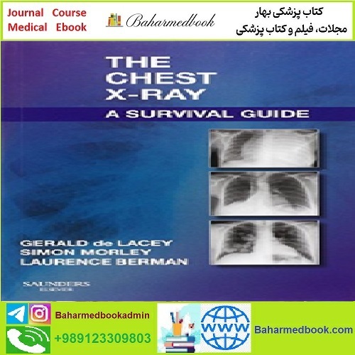 The Chest X Ray A Survival Guide TRUE PDF price 1€ - کتاب پزشکی بهار
