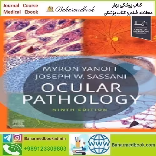 Ocular Pathology 2025 TRUE PDF price 5€ - کتاب پزشکی بهار