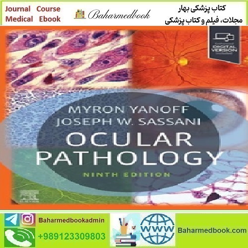 Ocular Pathology 2025 TRUE PDF price 5€ - کتاب پزشکی بهار