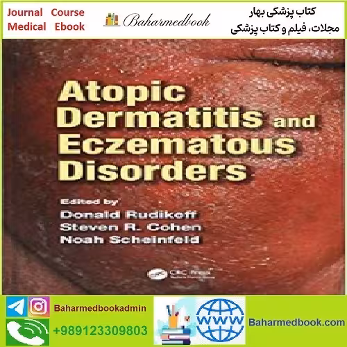 Atopic Dermatitis and Eczematous Disorders TRUE PDF price 1€ - کتاب پزشکی بهار