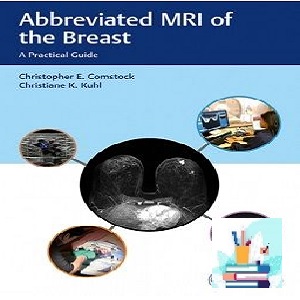 Abbreviated MRI of the Breast True PDF price 1€