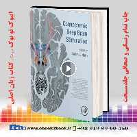 Connectomic Deep Brain Stimulation